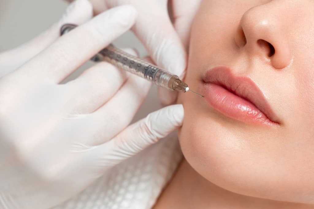 Woman receiving lip filler injection by practitioner in white gloves, demonstrating professional lip enhancement procedure for volume and definition using premium injectable brands