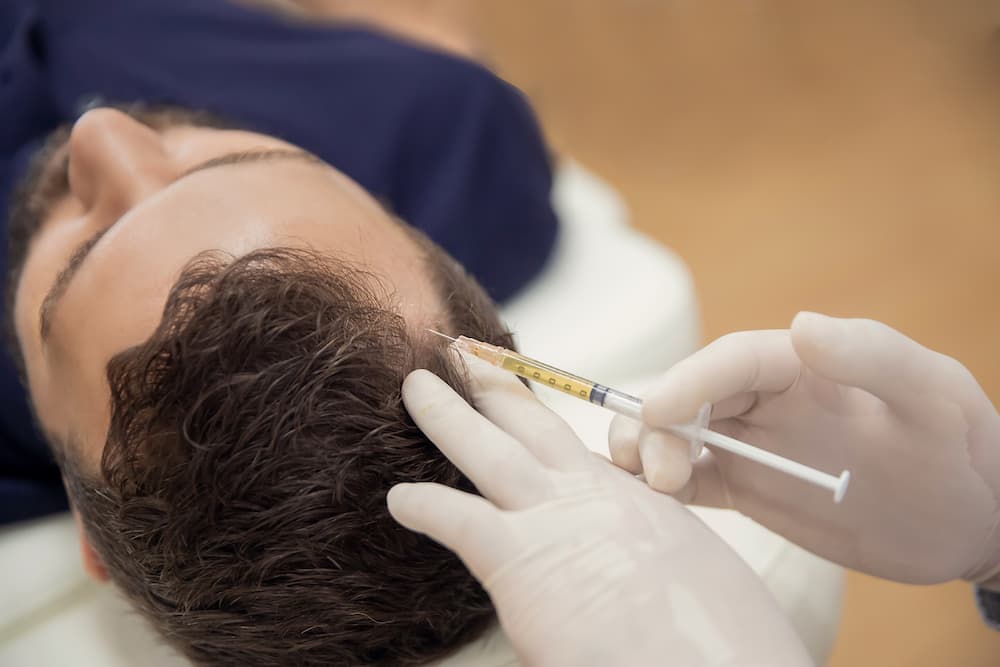 Man receiving PRP injection for hair restoration, illustrating PRP treatment for hair cost in 2025 and its role in promoting natural regrowth.