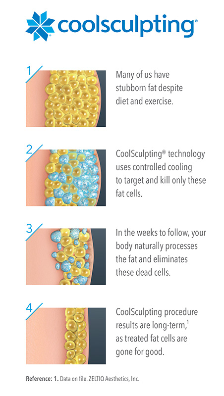 Coolsculpting – Body Contouring by Skin Deep Midtown Med Spa